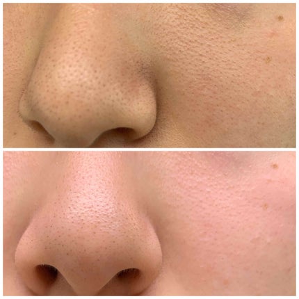 ディープクリアクレイ/ettusais/洗い流すパック・マスクを使ったクチコミ(2枚目)