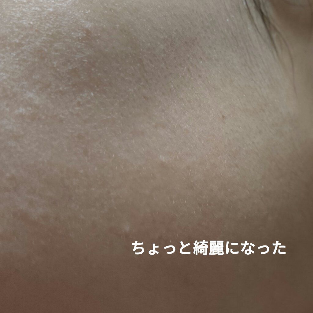 ããããBOMBãã¹ã¯/ã¯ãªã¢ã¿ãŒã³/ã·ãŒããã¹ã¯ã»ããã¯ã䜿ã£ãã¯ãã³ãïŒ5æç®ïŒ