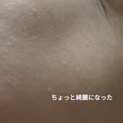 ããããBOMBãã¹ã¯/ã¯ãªã¢ã¿ãŒã³/ã·ãŒããã¹ã¯ã»ããã¯ã䜿ã£ãã¯ãã³ãïŒ5æç®ïŒ