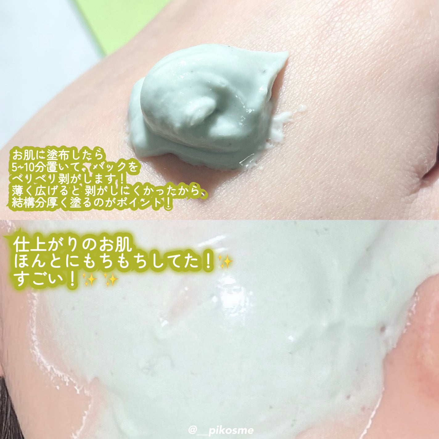 ドクダミ化粧水/ONE THING/化粧水を使ったクチコミ(7枚目)