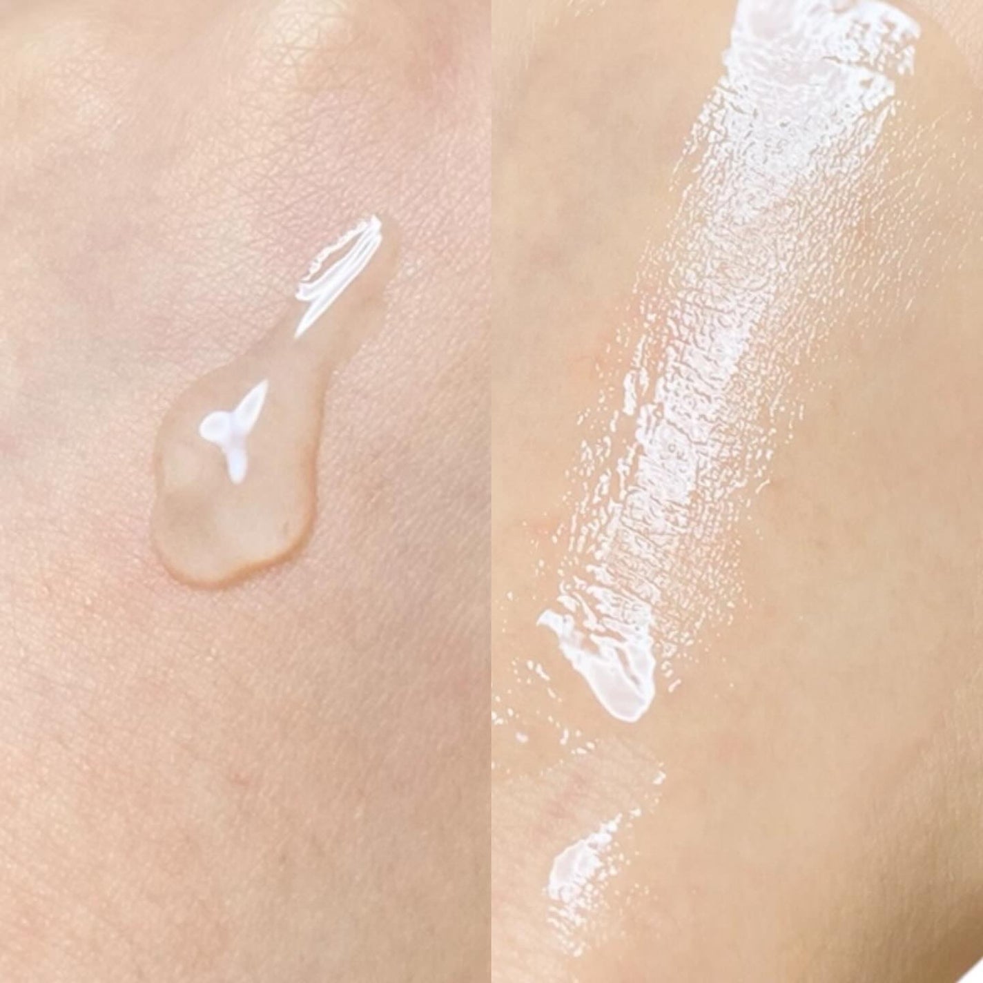 エーキュアトラブルカーミングセラム/obsero/美容液を使ったクチコミ(3枚目)