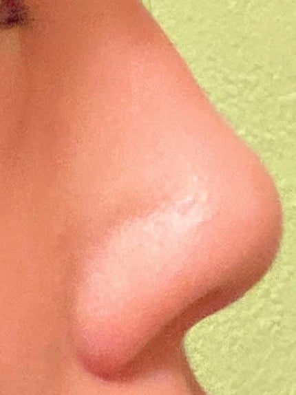 みんみみ on LIPS 「⚠️鼻の写真が写ります。 苦手な方は閲覧をお控えください。初め..」(5枚目)