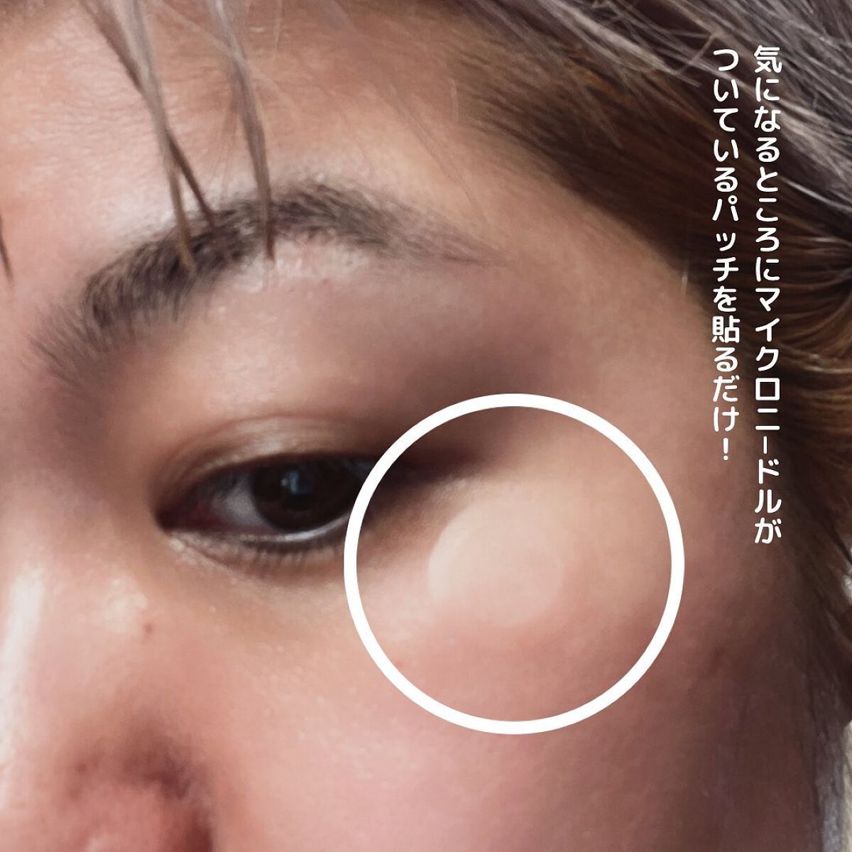 ディープビタCパッチ/MEDICUBE/その他スキンケアを使ったクチコミ（3枚目）