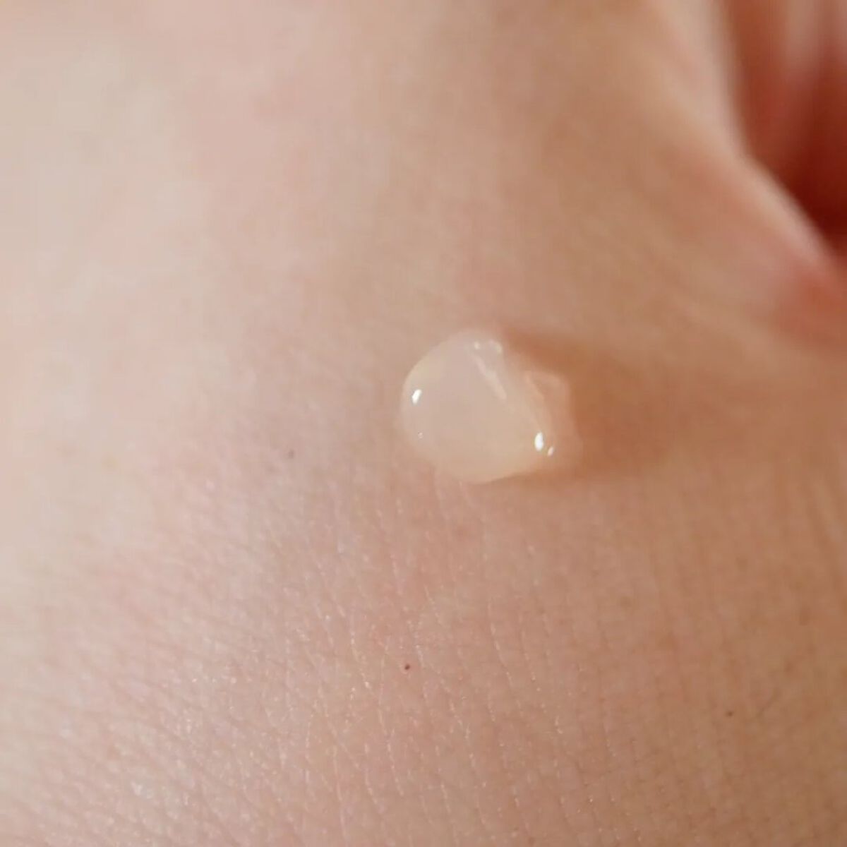 スポッツモイスチャーエイド/オルビス/美容液を使ったクチコミ（2枚目）