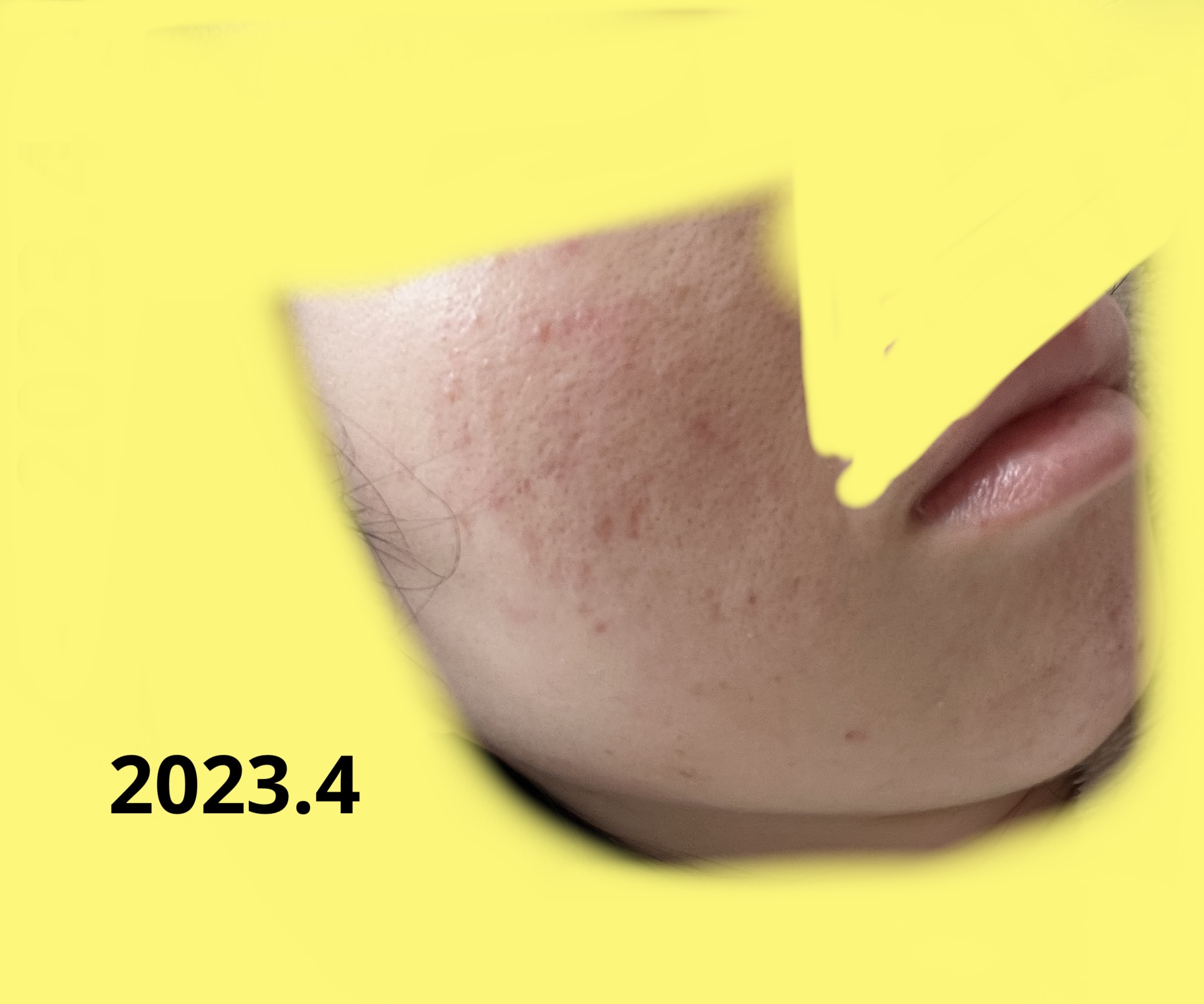 ジョンソン ベビーオイル 無香料/ジョンソンベビー/ボディオイルを使ったクチコミ（3枚目）