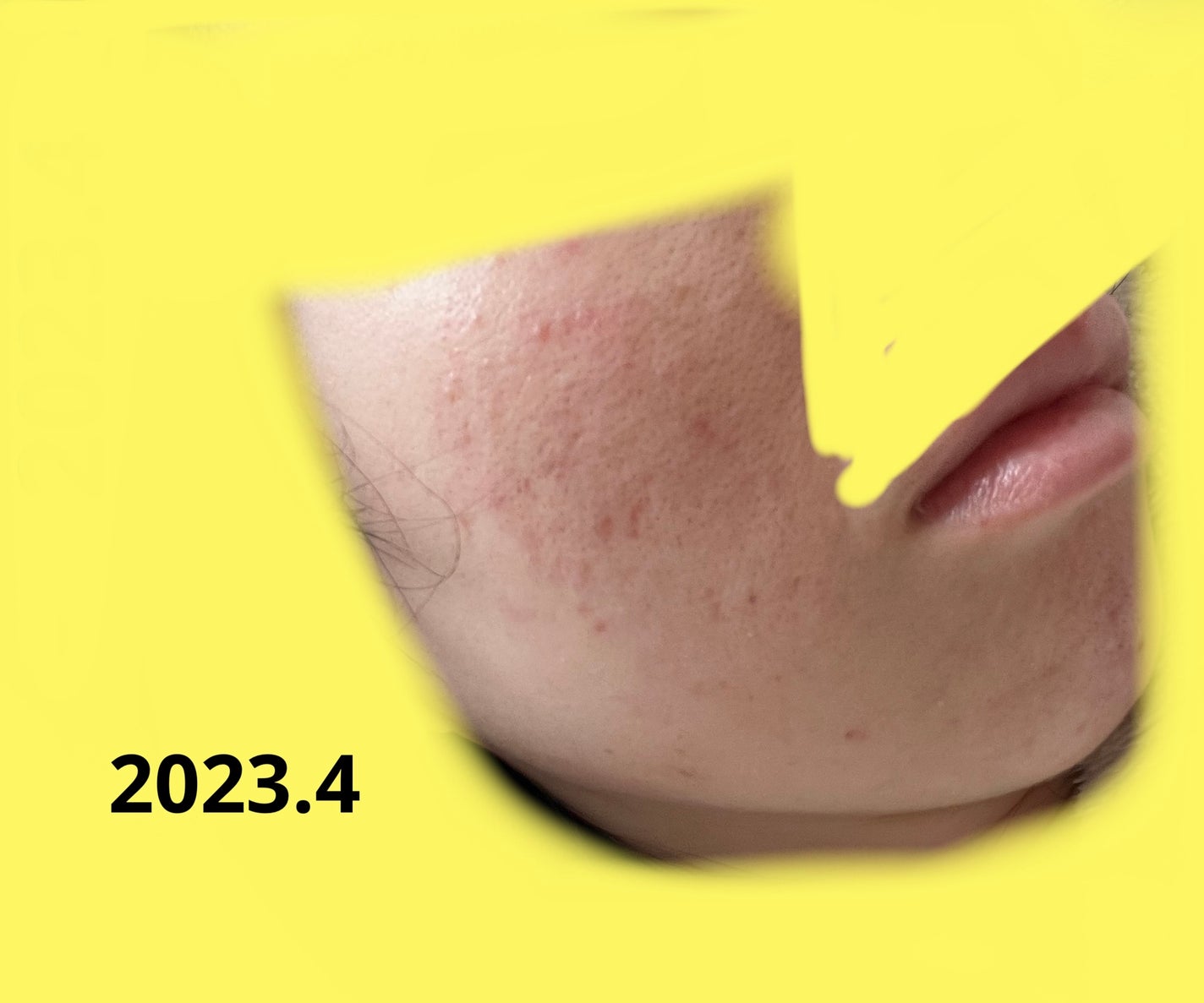 ジョンソン ベビーオイル 無香料/ジョンソンベビー/ボディオイルを使ったクチコミ(3枚目)