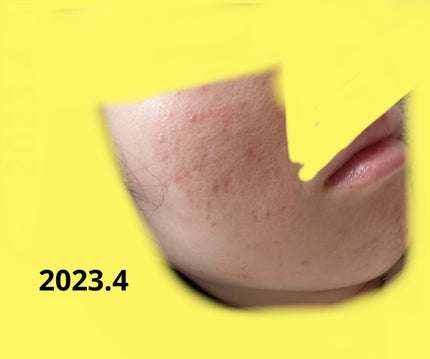 ベビーオイル 無香料/ジョンソンベビー/ボディオイルを使ったクチコミ(3枚目)