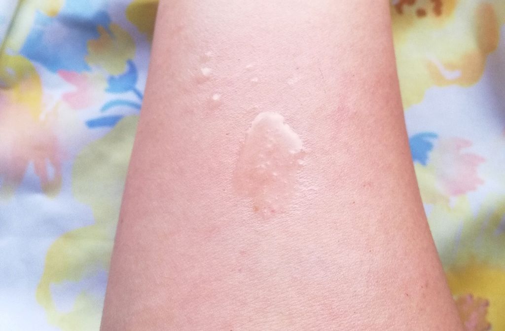 フィトチューン オイルシェイカー/DECORTÉ/フェイスオイルを使ったクチコミ(4枚目)