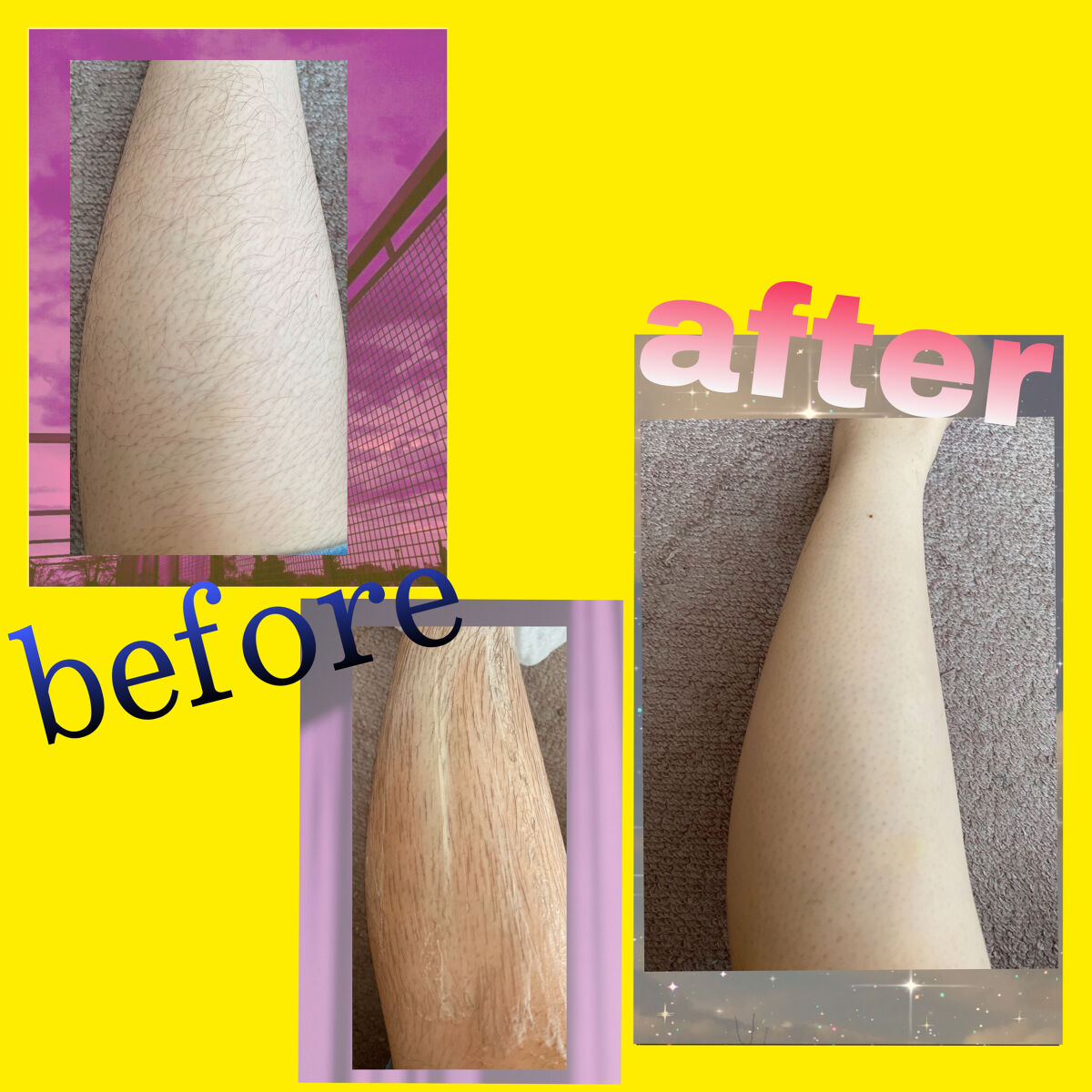 除毛クリーム ジャスミンハニー/スリンキータッチ セルフスパ/除毛クリームを使ったクチコミ（2枚目）