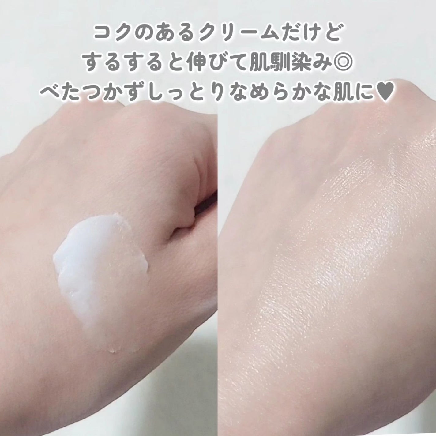 モイスチャライジング クリーム/セタフィル/ボディクリームを使ったクチコミ(3枚目)