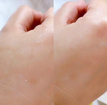 レディアンス ホワイト ローション/ステファニー/化粧水を使ったクチコミ(4枚目)