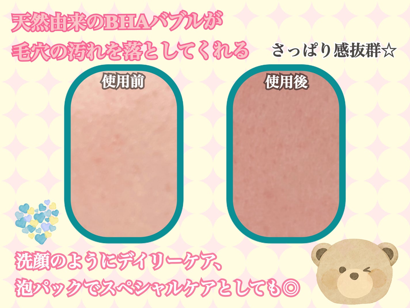 バイバイブラックヘッド グリーンティートックスバブルクレンザー/SOME BY MI/スクラブ・ゴマージュを使ったクチコミ(3枚目)