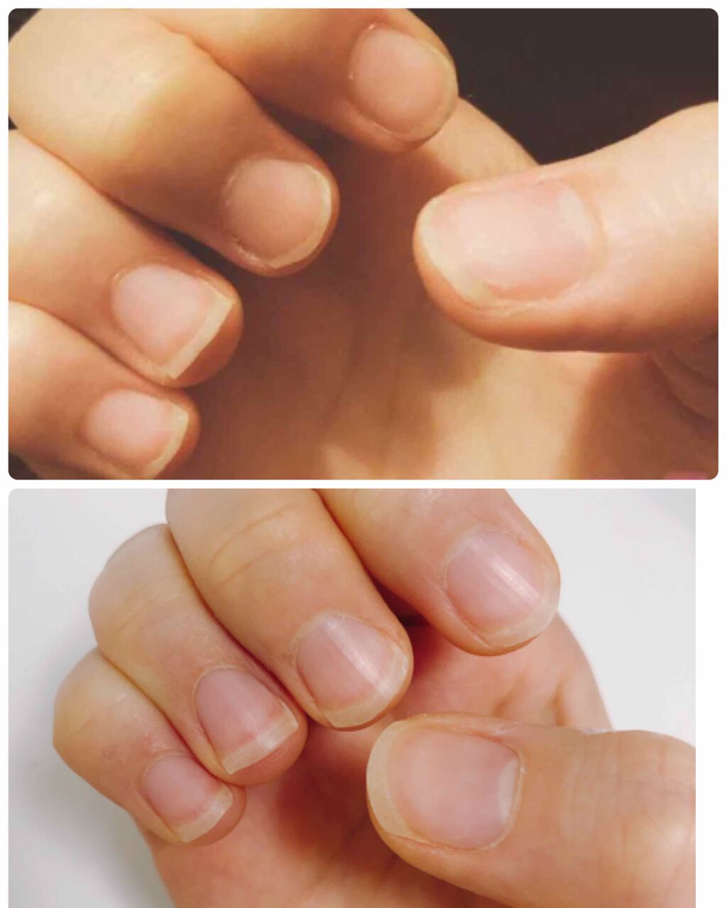 のばら on LIPS 「こんにちは!最後の投稿から11ヶ月経ってしまったのばらです🌹毎..」(3枚目)