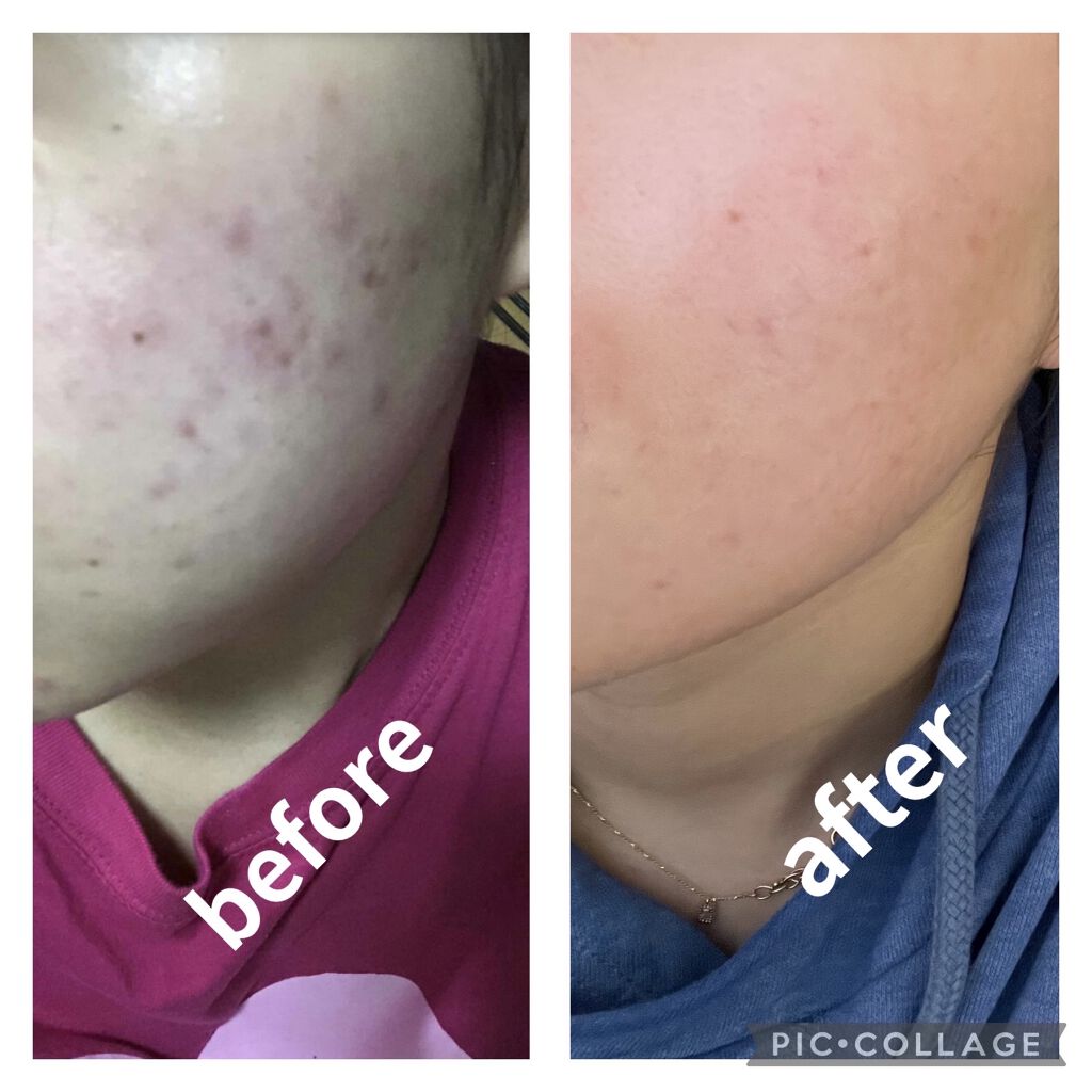 キールズ DS クリアリーブライト エッセンス[医薬部外品]/Kiehl's/美容液を使ったクチコミ（2枚目）