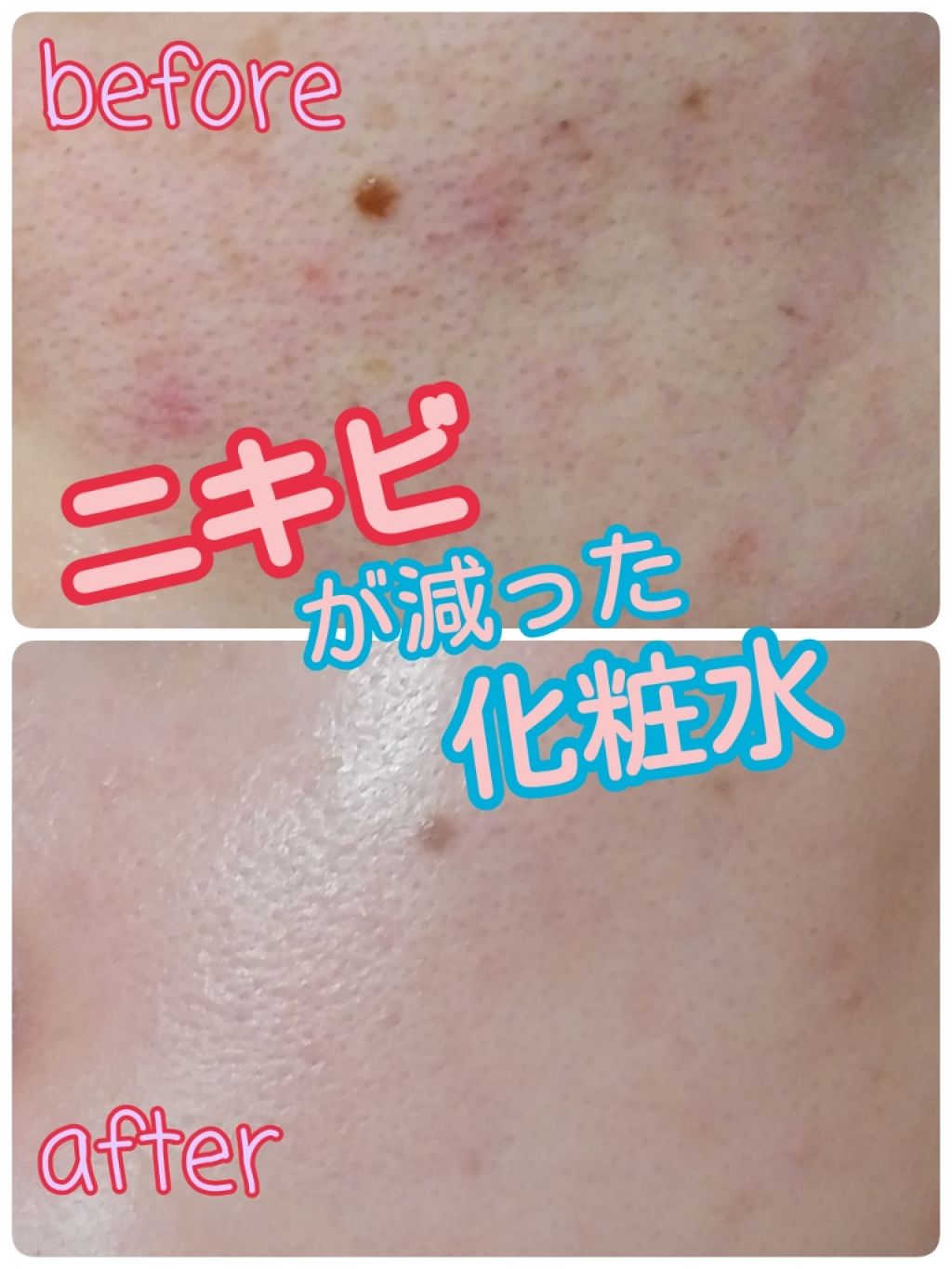 スキンコンディショナー しっとりタイプ/ルナメアAC/化粧水を使ったクチコミ（1枚目）