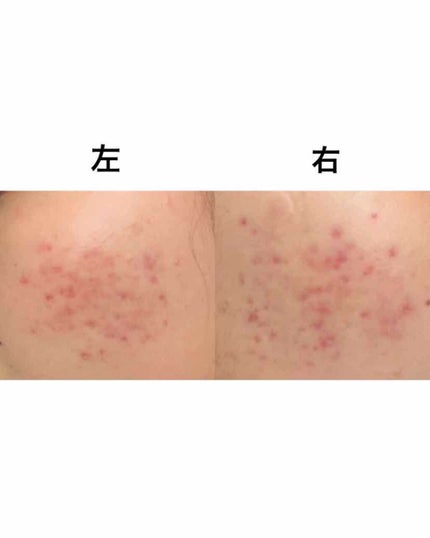 ハトムギ化粧水(ナチュリエ スキンコンディショナー R )/ナチュリエ/化粧水を使ったクチコミ(2枚目)