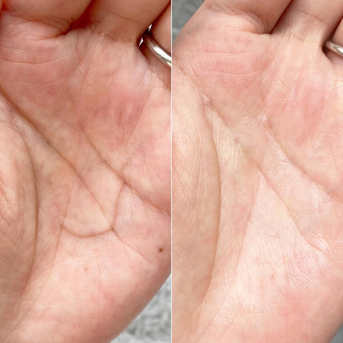 オルビスユー エッセンスローション /オルビス/化粧水を使ったクチコミ（2枚目）