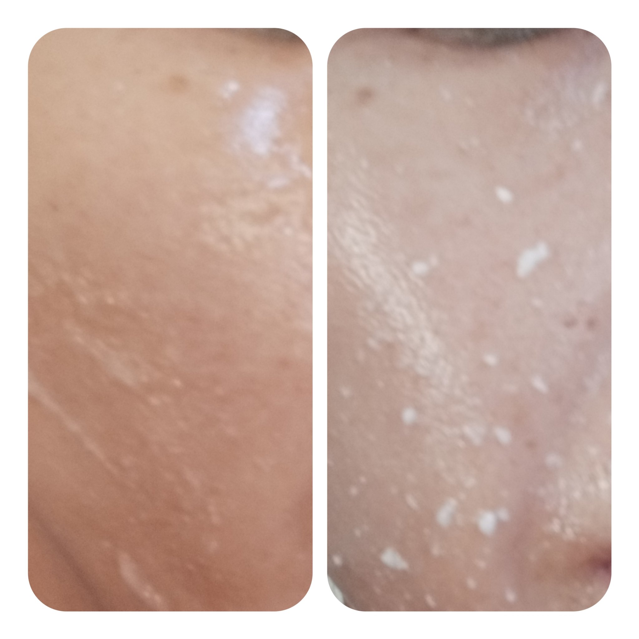 美白乃美人ピーリングジェル/ブレーンコスモス/ピーリングを使ったクチコミ（3枚目）