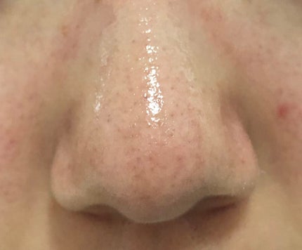 ハトムギ保湿ジェル(ナチュリエ スキンコンディショニングジェル)/ナチュリエ/美容液を使ったクチコミ(3枚目)