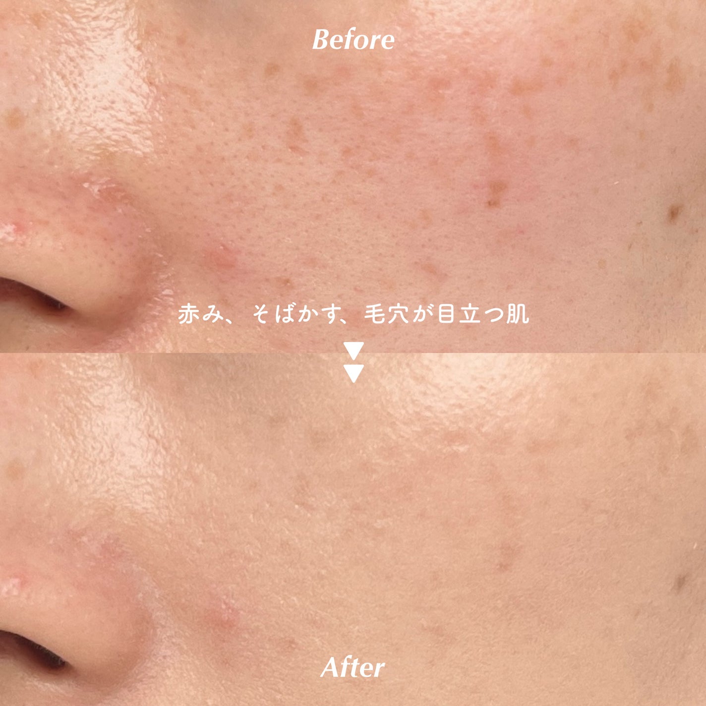 エッセンスリキッド EX/マキアージュ/リキッドファンデーションを使ったクチコミ(3枚目)