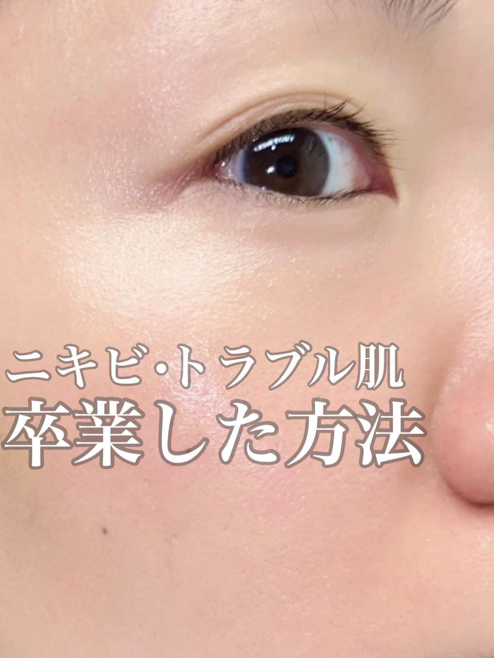 ビフィダバイオームコンプレックスセラム/manyo/美容液を使ったクチコミ（1枚目）