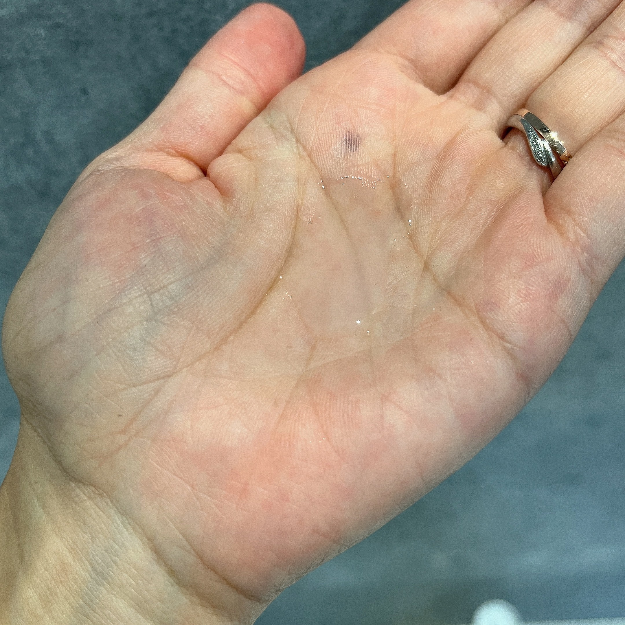 ヴィーガンリポソームレチノールセラム/SKIN&LAB/美容液を使ったクチコミ（3枚目）