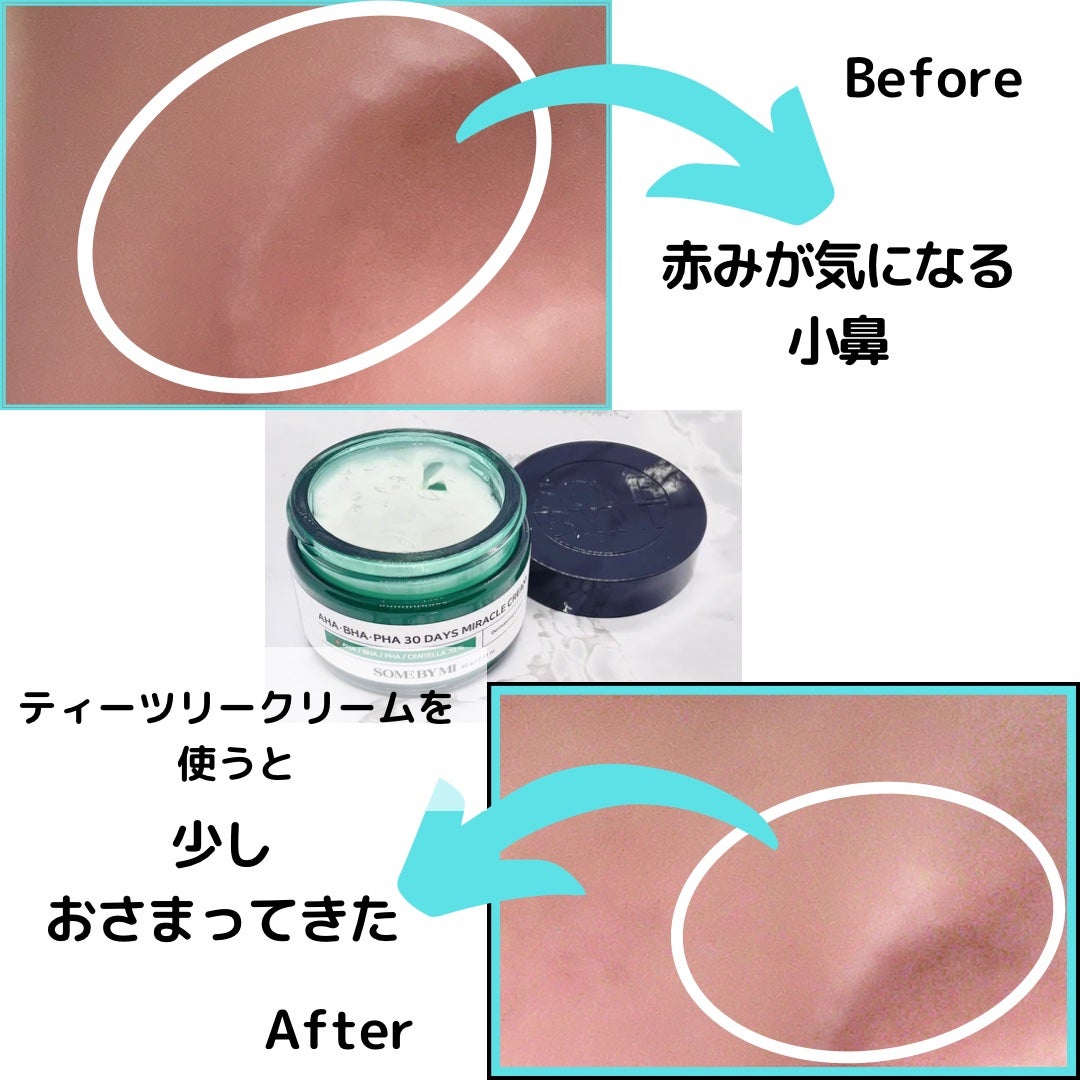 AHA·BHA·PHA 30デイズミラクルクリーム/SOME BY MI/フェイスクリームを使ったクチコミ(7枚目)