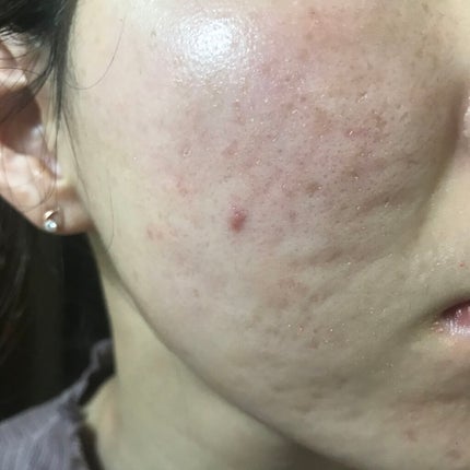 ゼン ウェア フルイド/DECORTÉ/リキッドファンデーションを使ったクチコミ(4枚目)