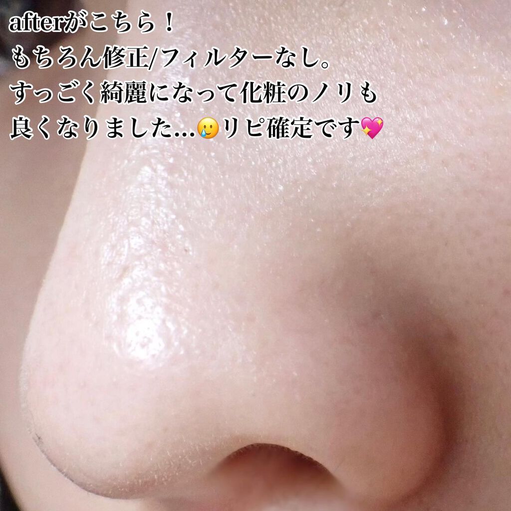 ブラックヘッドクリア2ステップノーズパッチ/DPU/シートマスク・パックを使ったクチコミ(5枚目)