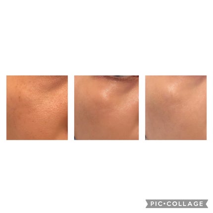 ダブル セラム バーム ファンデーション/Dr.Althea/クリーム・エマルジョンファンデーションを使ったクチコミ(4枚目)