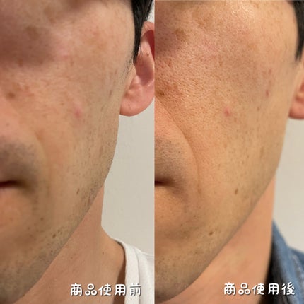 ちほ on LIPS 「「押忍セラム」こちらは普段のスキンケアに+αのうるおいを与える..」(4枚目)