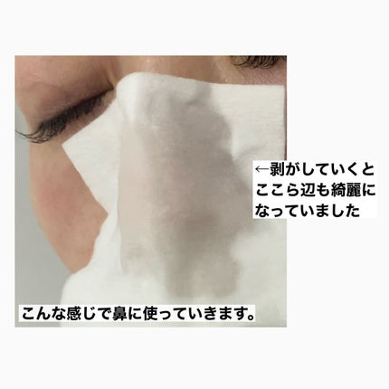 アクレオンセボエクストラクター/ANACIS/その他スキンケアを使ったクチコミ(6枚目)