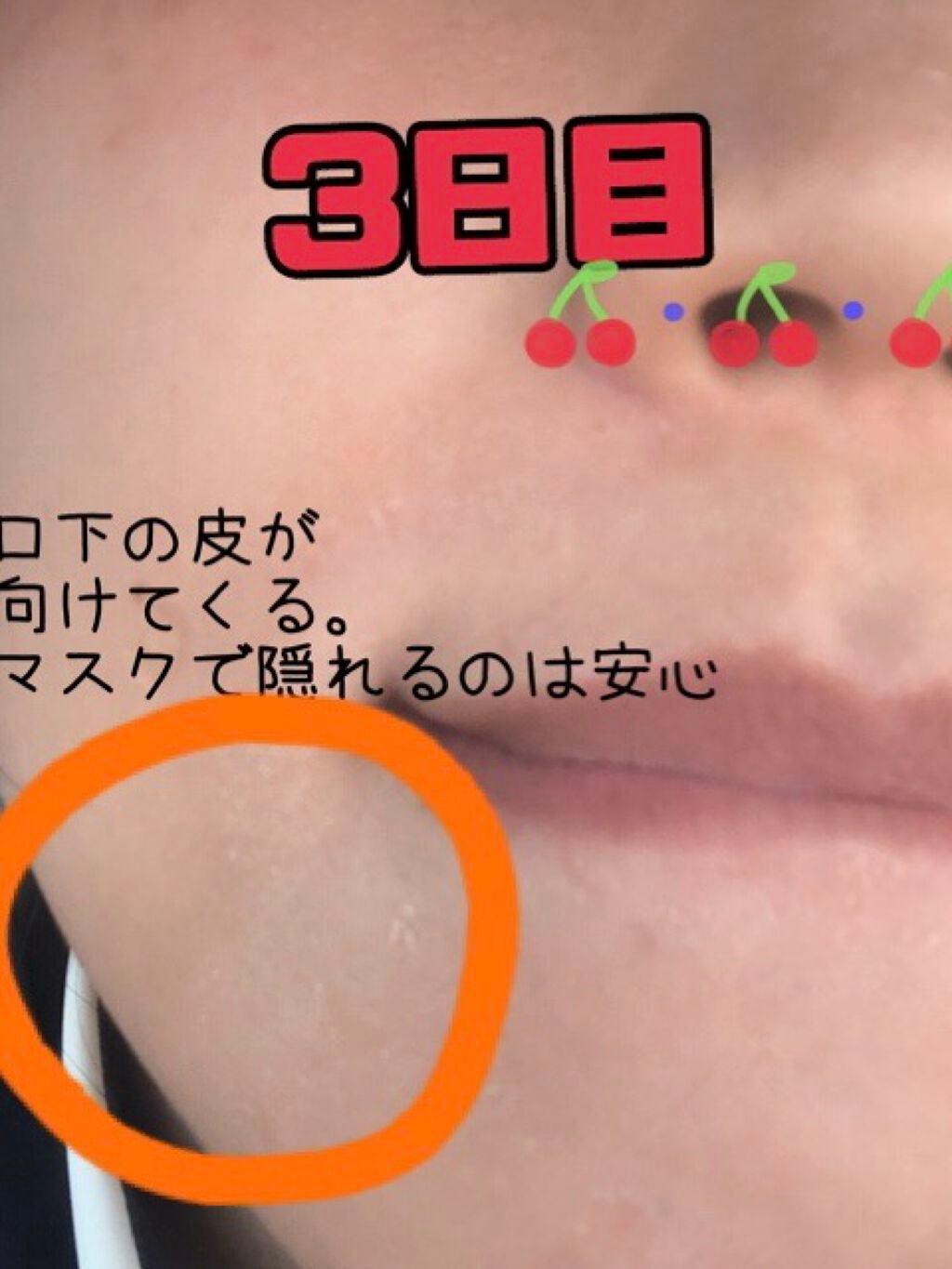 ミラミン/ZO Skin Health/フェイスクリームを使ったクチコミ(3枚目)