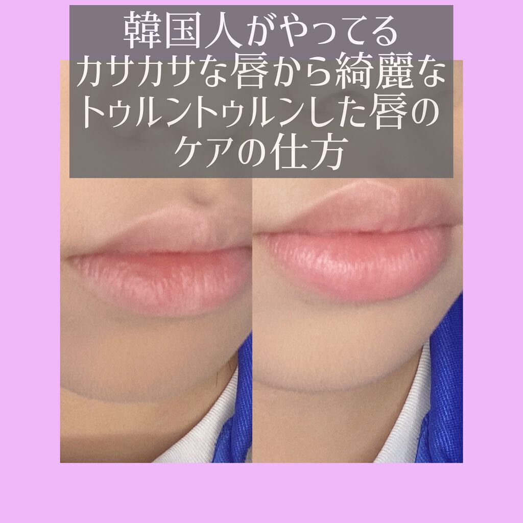 オリジナル ピュアスキンジェリー/ヴァセリン/ボディクリームを使ったクチコミ（1枚目）