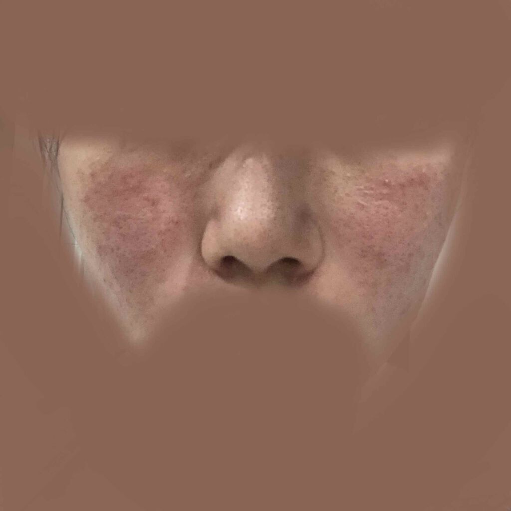 らら on LIPS 「助けてください(;;)今年の3月頃の花粉がキツくなってきたあた..」(2枚目)