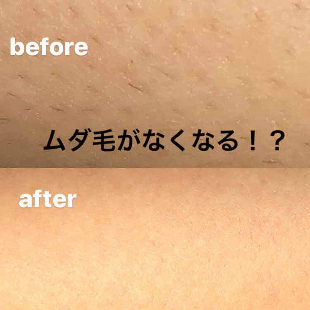 ハイジドルフジェル アロエ/ハイジドルフ/ボディローションを使ったクチコミ（1枚目）