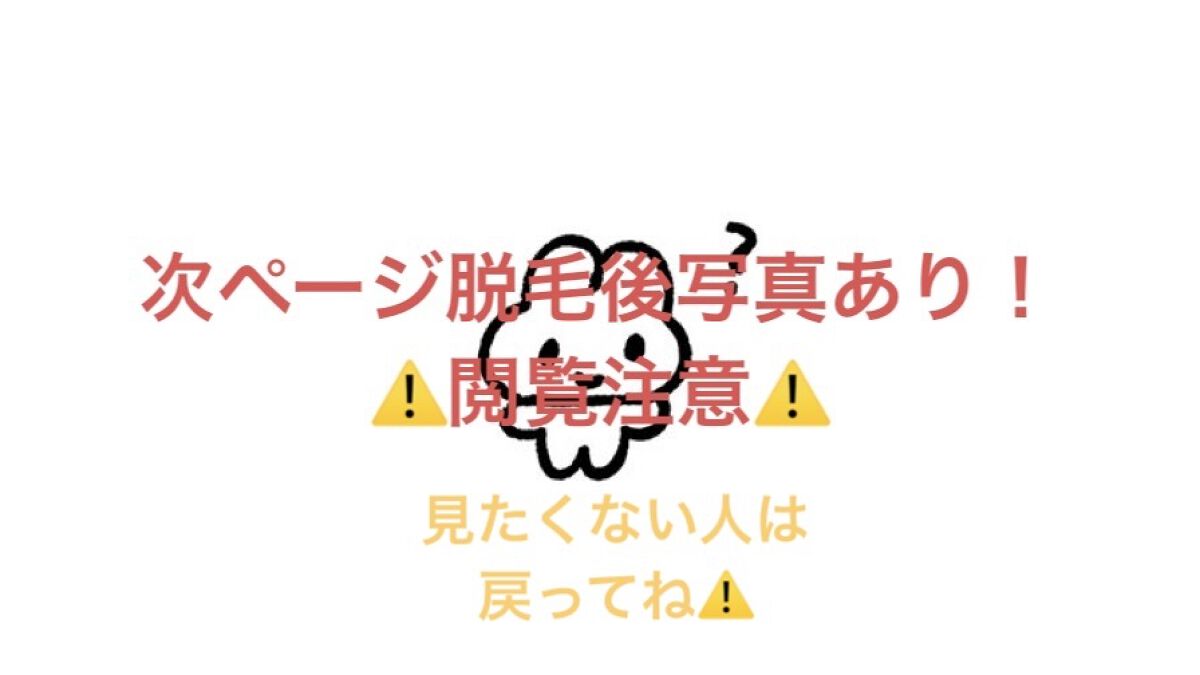  エピワックスシート /TBC/ムダ毛ケアを使ったクチコミ（3枚目）