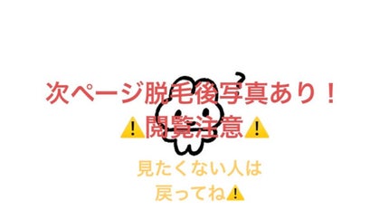 エピワックスシート /TBC/ムダ毛ケアを使ったクチコミ(3枚目)