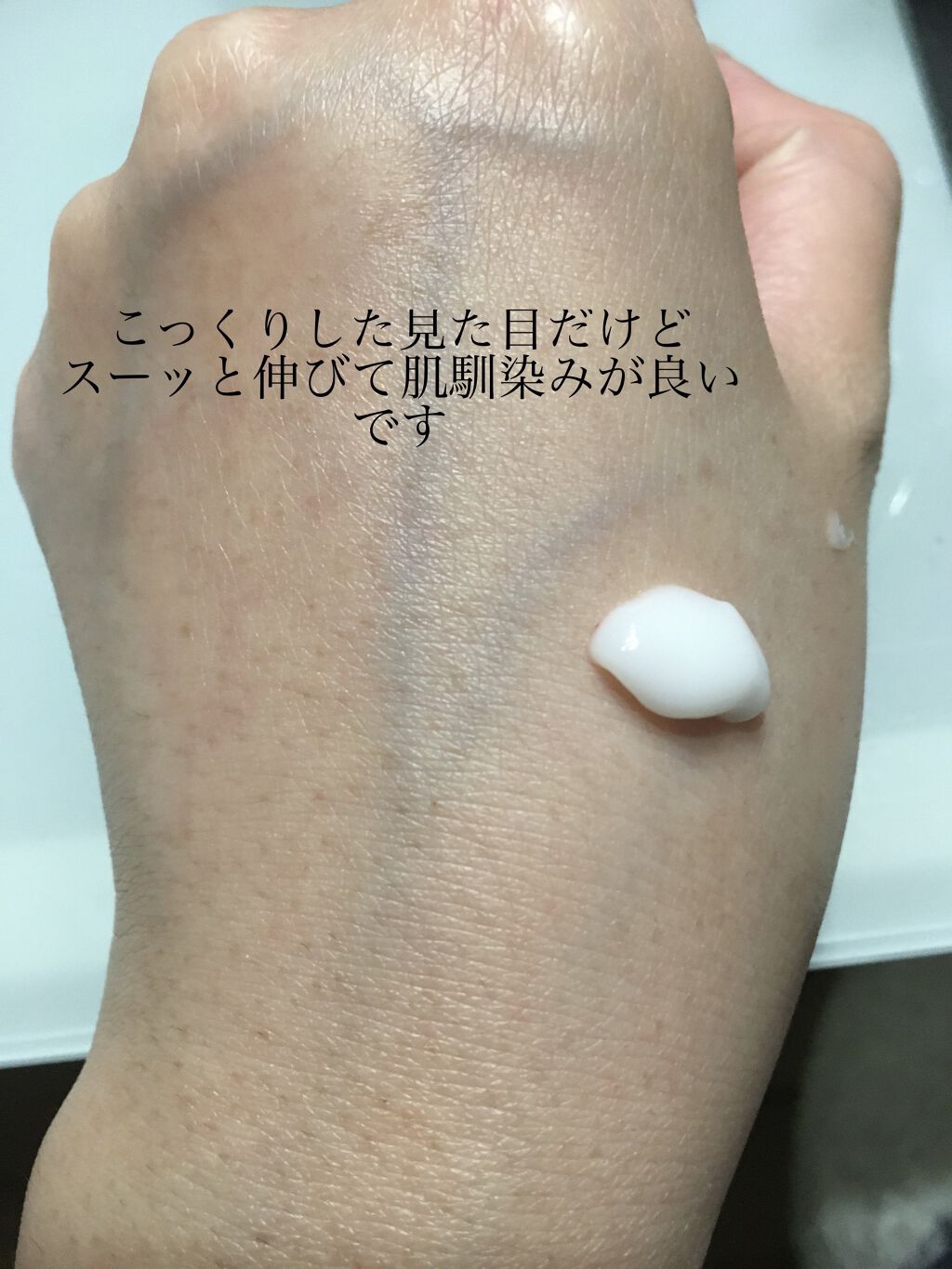 薬用オルリッチ/エクスボーテ/乳液を使ったクチコミ（2枚目）