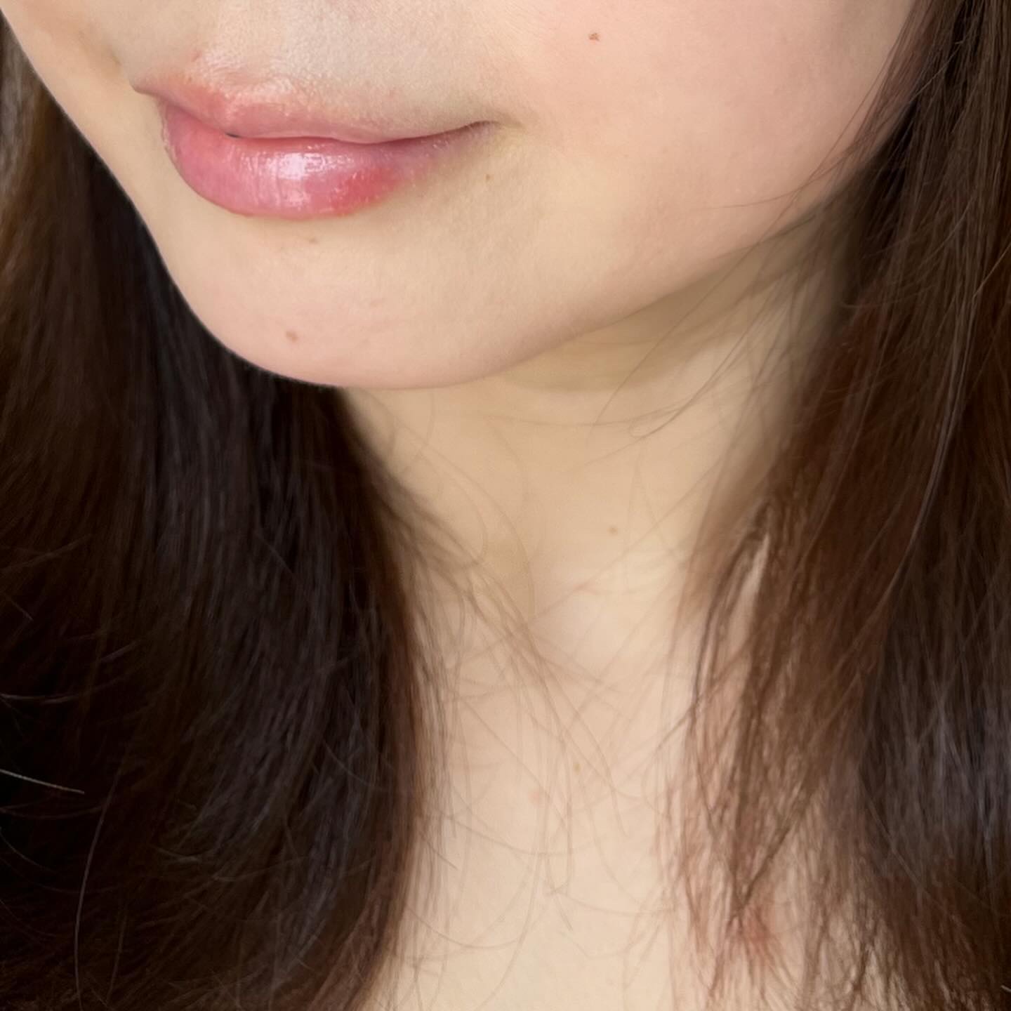 フラルネ リップバー S 〈リップトリートメント〉/ALBION/リップケアを使ったクチコミ（3枚目）