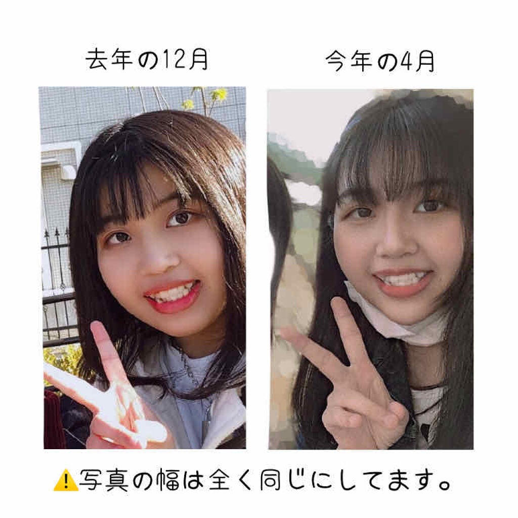 寝ながらメディキュット フルレッグ/メディキュット/着圧ソックス・レギンスを使ったクチコミ(2枚目)