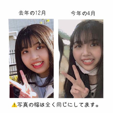 寝ながらメディキュット フルレッグ/メディキュット/着圧ソックス・レギンスを使ったクチコミ(2枚目)