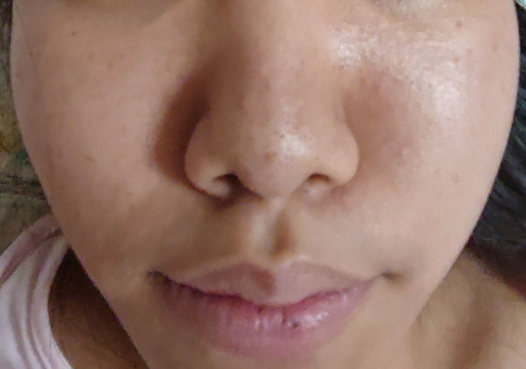 薬用泡のふんわり洗顔/スキンライフ/泡洗顔を使ったクチコミ（2枚目）