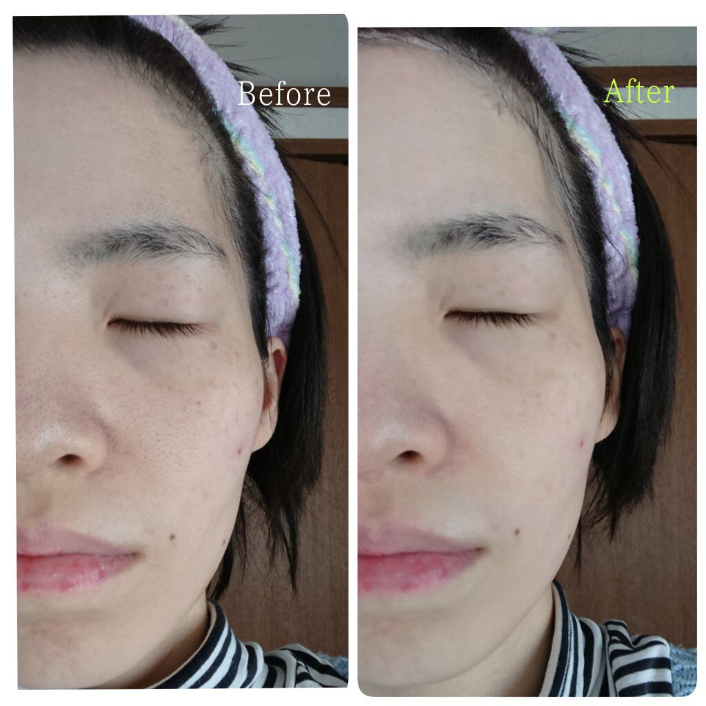 ðð®ðððð¢â¡ on LIPS ãããã«ã¡ã¯ïŒCELLCREAæ¿å¯çé
žæ³¡ããã¯ãã詊ãããŸãã..ãïŒ7æç®ïŒ