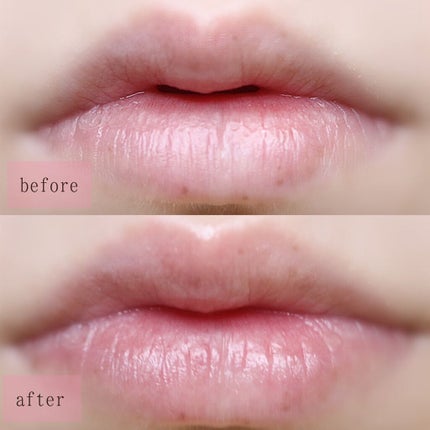 ディオール アディクト リップ マキシマイザー セラム/Dior/リップ美容液を使ったクチコミ(5枚目)