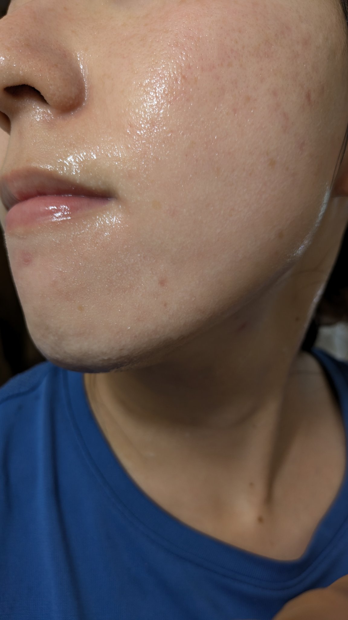 A2+NAG2ソリューション/The Ordinary/美容液を使ったクチコミ（2枚目）