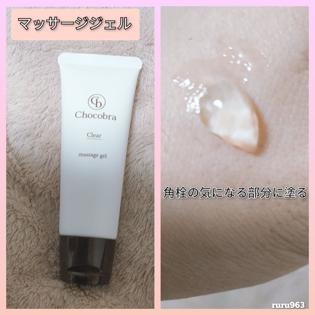 チョコブラ スペシャル毛穴ケアセット/Chocobra/スキンケアキットを使ったクチコミ（2枚目）