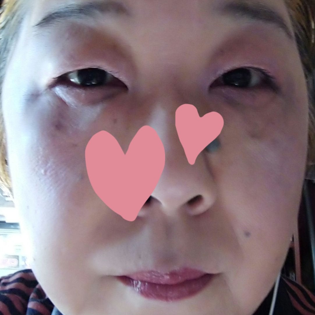 スキニーリッチシャドウ/excel/アイシャドウパレットを使ったクチコミ(3枚目)