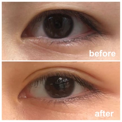 LJ 二重テープ ヌーディポイント/LOUJENE/二重まぶた用アイテムを使ったクチコミ(1枚目)