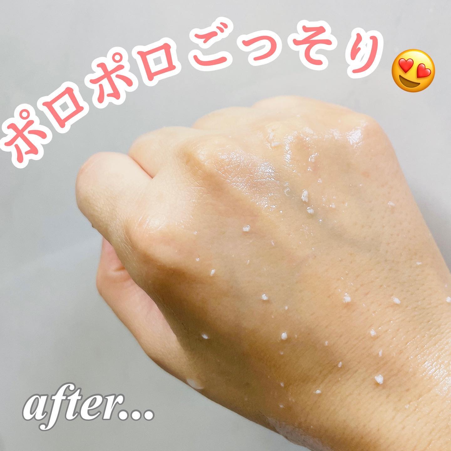 美白乃美人ピーリングジェル/ブレーンコスモス/ピーリングを使ったクチコミ（3枚目）